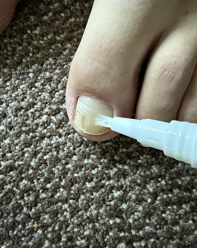 After treatment