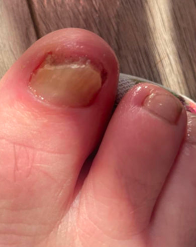 After treatment