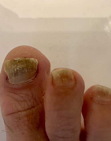 Before treatment