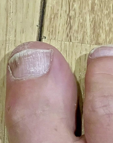 After treatment