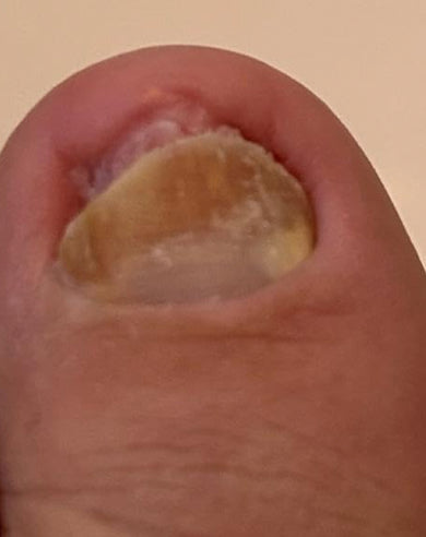 Before treatment