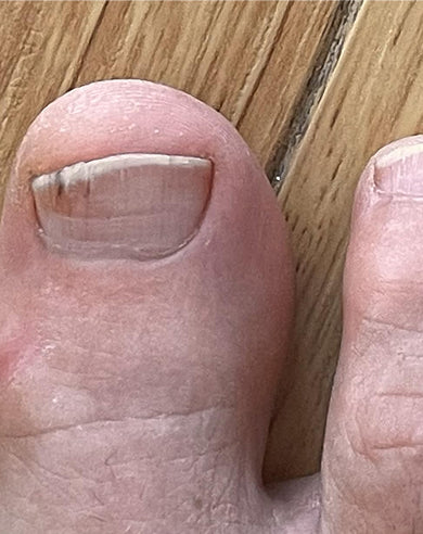 Before treatment
