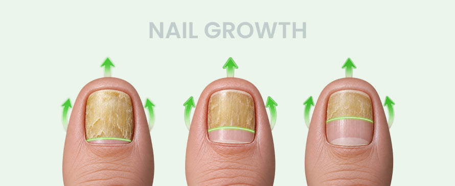 Crecimiento de las uñas