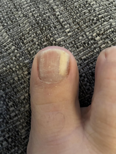 Before treatment