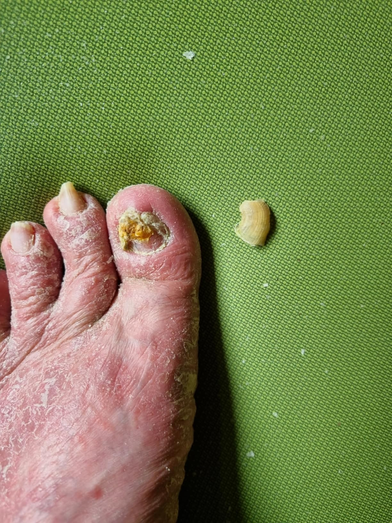 After treatment